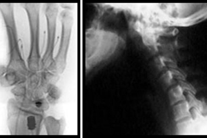 X-ray images